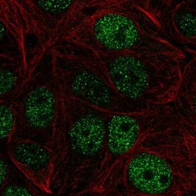 Immunocytochemistry/ Immunofluorescence: ZHX1 Antibody [NBP2-55880]