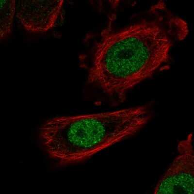 Immunocytochemistry/ Immunofluorescence: ZHX1 Antibody [NBP2-56728]