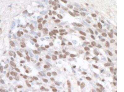Immunohistochemistry-Paraffin: ZHX1 Antibody [NB600-244]