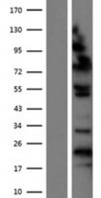 Western Blot: ZHX1 Overexpression Lysate [NBP2-07518]