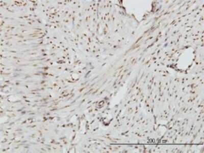 Immunohistochemistry-Paraffin: ZHX2 Antibody (5E2) [H00022882-M01]