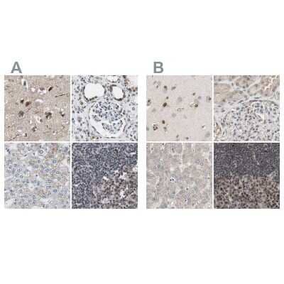 Immunohistochemistry-Paraffin: ZHX2 Antibody [NBP1-82955]
