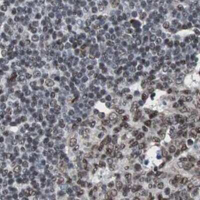 Immunohistochemistry-Paraffin: ZHX2 Antibody [NBP1-82955]