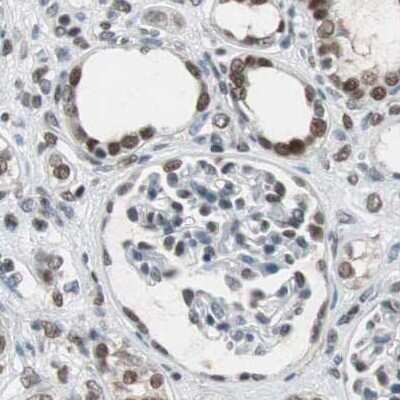 Immunohistochemistry-Paraffin: ZHX2 Antibody [NBP1-82955]
