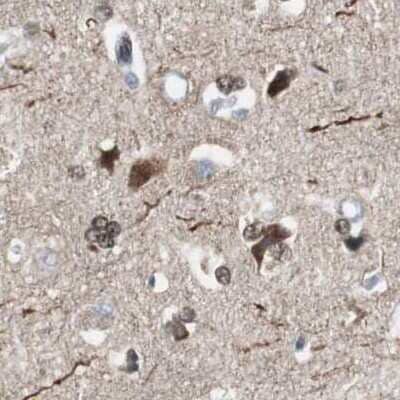 Immunohistochemistry-Paraffin: ZHX2 Antibody [NBP1-82955]