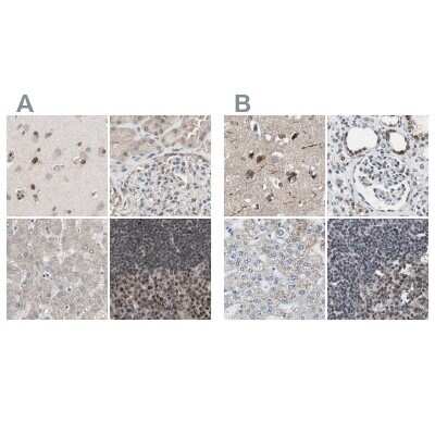 Immunohistochemistry-Paraffin: ZHX2 Antibody [NBP1-82956]