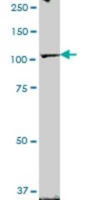 Western Blot: ZHX2 Antibody [H00022882-B01P]