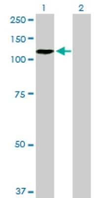 Western Blot: ZHX2 Antibody [H00022882-B01P]