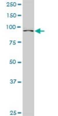 Western Blot: ZHX2 Antibody [H00022882-D01P]