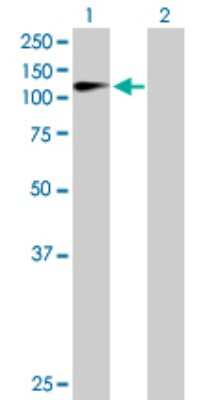 Western Blot: ZHX2 Antibody [H00022882-D01P]