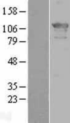 Western Blot: ZHX2 Overexpression Lysate [NBL1-18033]