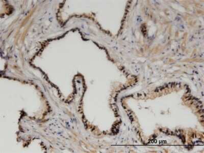 Immunohistochemistry-Paraffin: ZHX3 Antibody (1D9) [H00023051-M03]