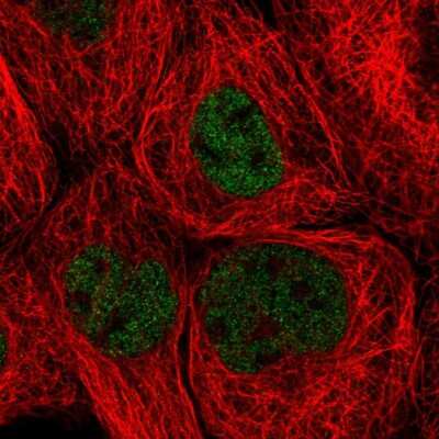 Immunocytochemistry/ Immunofluorescence: ZHX3 Antibody [NBP2-55486]