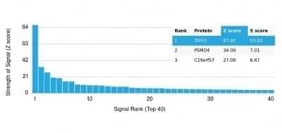 Protein Array: ZHX3 Antibody (PCRP-ZHX3-1G3)Azide and BSA Free [NBP3-14230]