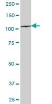 Western Blot: ZHX3 Antibody [H00023051-B01P]