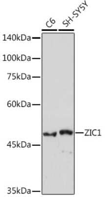 Western Blot: ZIC1 Antibody (6B5O9) [NBP3-15774]