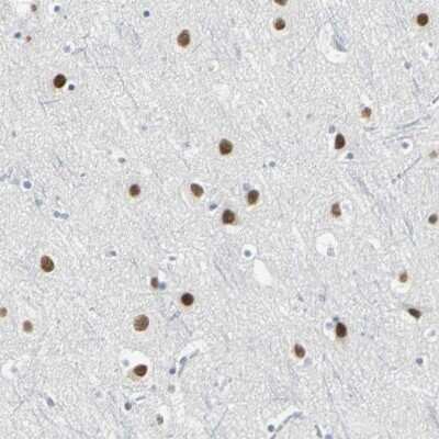 Immunohistochemistry-Paraffin: ZIC1 Antibody [NBP1-86833]