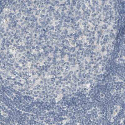 Immunohistochemistry-Paraffin: ZIC1 Antibody [NBP1-86833]