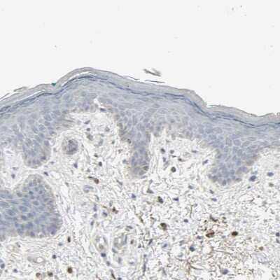 Immunohistochemistry-Paraffin: ZIC1 Antibody [NBP1-86833]