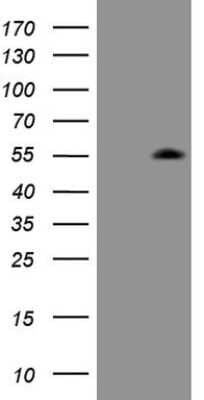 Western Blot: ZIC3 Antibody (OTI1G7) [NBP2-46414]