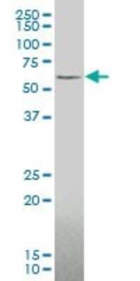 Western Blot: ZIC3 Antibody (2C1) [H00007547-M05]