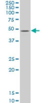 Western Blot: ZIC3 Antibody (2C1) [H00007547-M05]