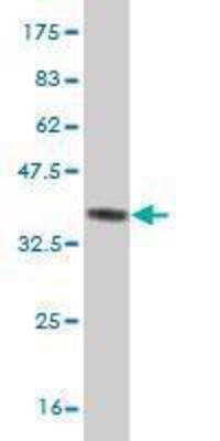 Western Blot: ZIC3 Antibody (2D3) [H00007547-M02]