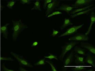 Immunocytochemistry/ Immunofluorescence: ZIC3 Antibody (2G1) [H00007547-M06]