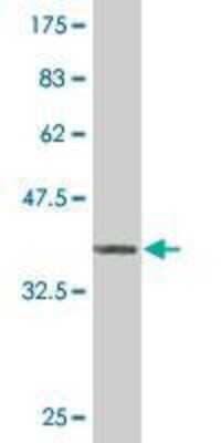 Western Blot: ZIC3 Antibody (2G1) [H00007547-M06]