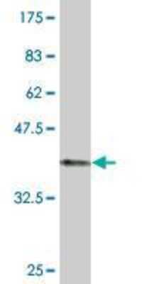 Western Blot: ZIC3 Antibody (4F7) [H00007547-M01]