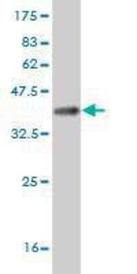 Western Blot: ZIC3 Antibody (4G6) [H00007547-M04]