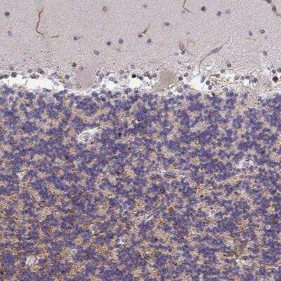 Immunohistochemistry: ZIC3 Antibody [NBP2-33669]