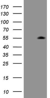 Western Blot: ZIC3 Antibody (OTI1G7)Azide and BSA Free [NBP2-74925]