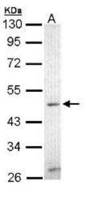 Western Blot: ZIC3 Antibody [NBP1-33207]