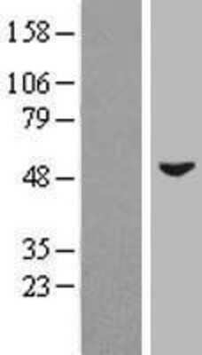 Western Blot: ZIC3 Overexpression Lysate [NBP2-08013]