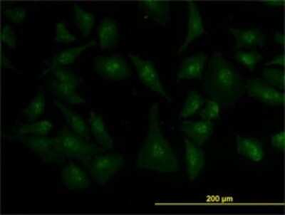 Immunocytochemistry/ Immunofluorescence: ZIC4 Antibody (1A9) [H00084107-M05]