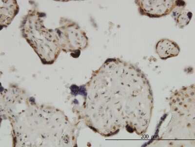 Immunohistochemistry-Paraffin: ZIC4 Antibody (1A9) [H00084107-M05]