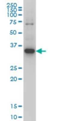 Western Blot: ZIC4 Antibody (1A9) [H00084107-M05]