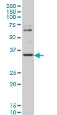 Western Blot: ZIC4 Antibody (2C2) [H00084107-M07]