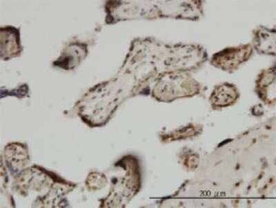 Immunohistochemistry-Paraffin: ZIC4 Antibody (3A2) [H00084107-M09]