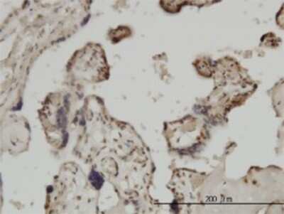 Immunohistochemistry-Paraffin: ZIC4 Antibody (3D5) [H00084107-M06]
