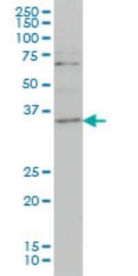 Western Blot: ZIC4 Antibody (3D5) [H00084107-M06]