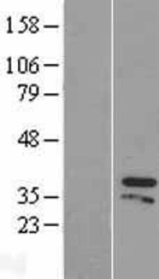 Western Blot: ZIC4 Overexpression Lysate [NBP2-06067]