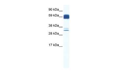 Western Blot: ZIC5 Antibody [NBP2-84346]