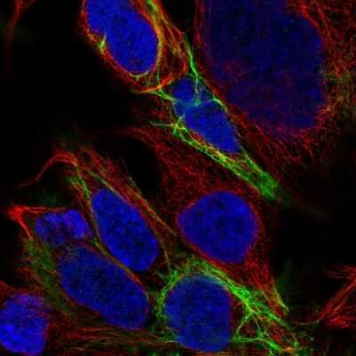 Immunocytochemistry/ Immunofluorescence: ZIK1 Antibody [NBP2-32507]