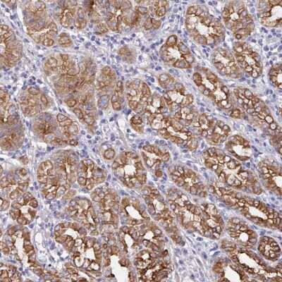 Immunohistochemistry-Paraffin: ZIK1 Antibody [NBP2-32507]