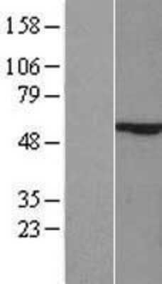 Western Blot: ZIK1 Overexpression Lysate [NBP2-08766]