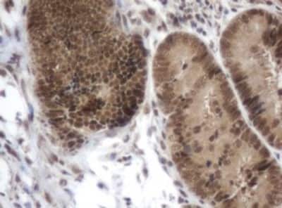 Immunohistochemistry: ZIM2 Antibody (OTI6D12) [NBP2-46415]