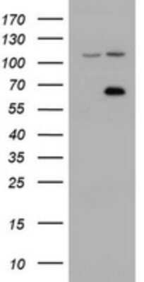 Western Blot: ZIM2 Antibody (OTI6D12) [NBP2-46415]