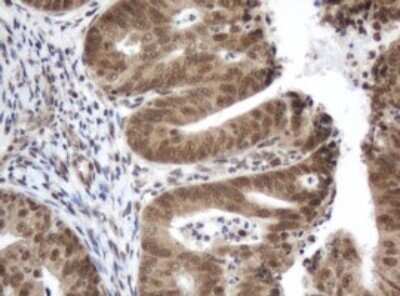 Immunohistochemistry: ZIM2 Antibody (OTI6D12) - Azide and BSA Free [NBP2-74928]